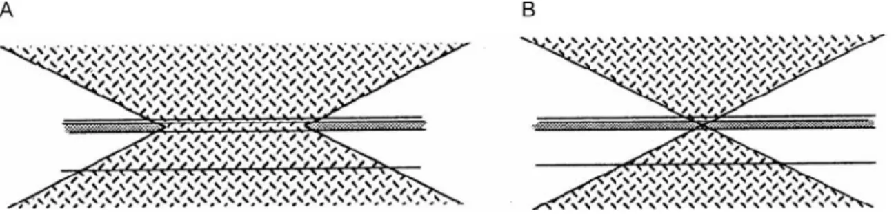 Figura 6 - A) Microscopia de fluorescência convencional; B) Microscopia confocal de  varredura a laser (ALVAREZ-ROMAN et al., 2004)