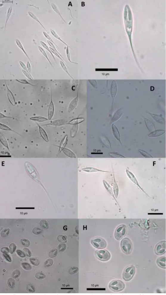 Figura  1  –  Fotomicrografias  de  esporos  a  fresco  de  mixosporídeos  parasitas  de  peixes de água doce da América do Sul
