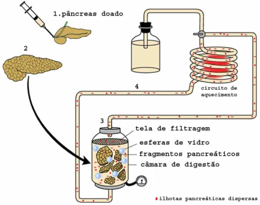 Figura 3. Principais etapas do processo de isolamento de ilhotas pancreáticas a  partir de um pâncreas humano doado: 1)perfusão do pâncreas captado com solução  de colagenase, 2)pâncreas distendido, 3)digestão dos fragmentos pancreáticos (câmara de  Ricord