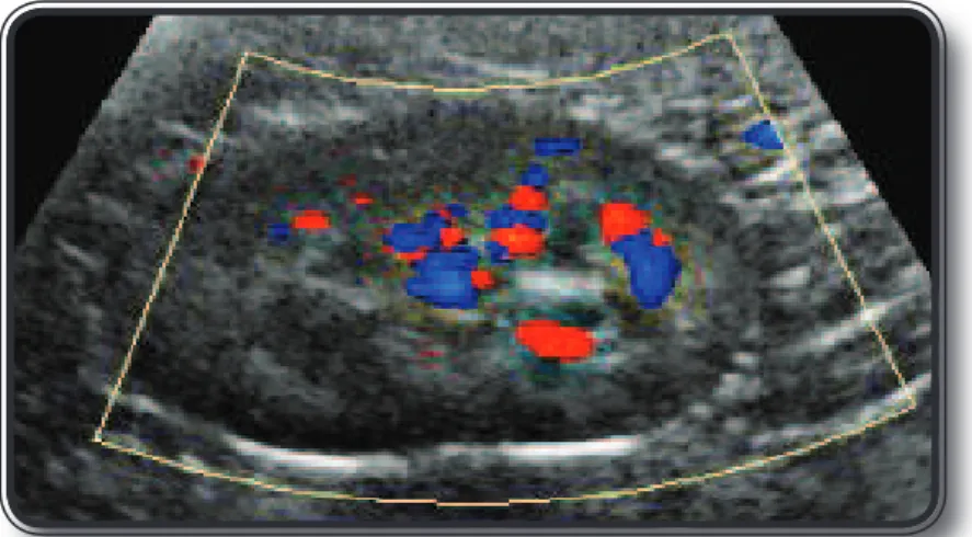 Figura 13 - Mapeamento Doppler colorido de rim normal de gato da raça persa.