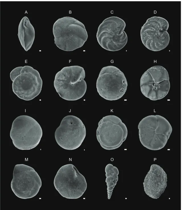 Figure 8: Photomicrographs of some of main species that compound the benthic  foraminiferal fauna from cores BS-6 e BS-8