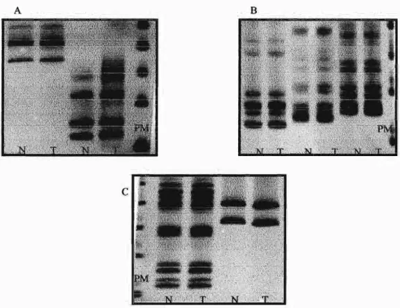Figura 8 - Análise de produtos de PCR de regiões  microssatélites  em gel de poliacrilamida com diferentes concentrações de uréia