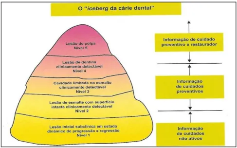 Figura 1 – “O Iceberg da cárie dentária”: níveis de diagnóstico de cárie em relação à necessidade de  procedimentos de promoção de saúde e tratamento restaurador
