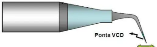 Figura 6 – Ponta ultrassônica CVD em movimento de vibração ântero-posterio 