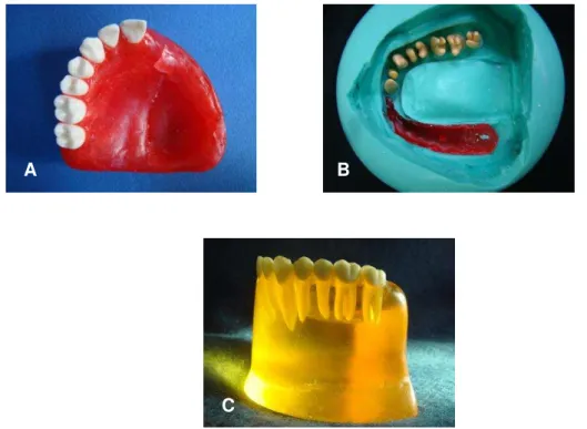 Figura 4.1  –  Duplicação do modelo fotoelástico: A  –  modelo de maxila; B  –  molde em Silibor® 