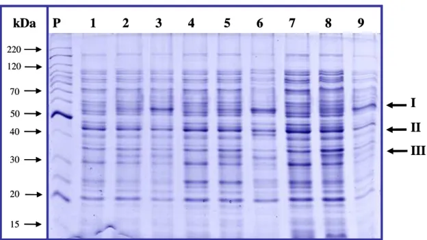 Figura  5  –  Proteína  em  gel  SDS-PAGE  para  as  linhagens  de  Klebsiella  oxytoca  submetidas  ao  tratamento  com  acetochlor