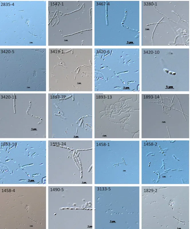 Figure  3:  Complex  spore-crystal  of  Bacillus  thuringiensis  strains  observed  in  interferential phase contrast microscope