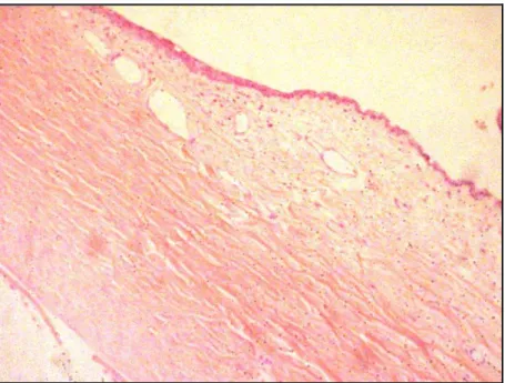Figura 4 -  Ausência de infiltrado inflamatório em meio ao  tecido muscular (hematoxilina-eosina 50X) 