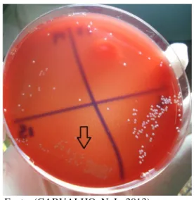 Figura 1 - Colônias típicas de Streptococcus  spp. 