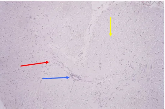 Figura 10 - Corte histológico da medula espinhal do  G. carbonaria , em secção  transversal da intumescência cérvico-dorsal, onde se pode observar  na área central a substância cinzenta (→) e na área periférica a  substância branca (→)