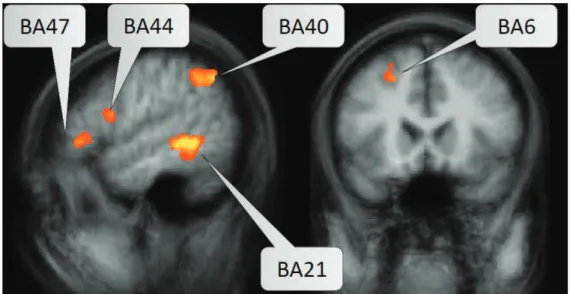 Figure 10 – Activation pattern from a developers brain while comprehending code.