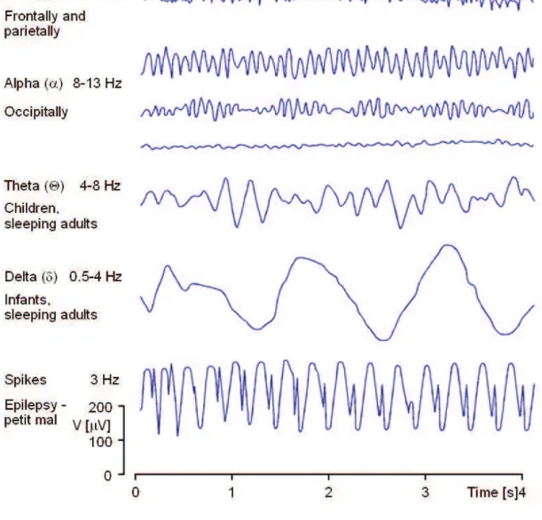 Figure 12 – Sample of EEG waves grouped by type over time.