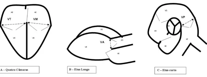 Figura 1: Desenho esquemático dos cortes ecocardiográficos básicos utilizados no estudo  demonstrando como foram realizadas as medidas dos diâmetros