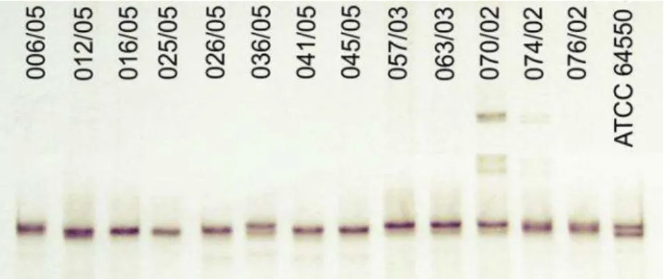 Figura 2  –  Gel de poliacrilamida a 6% mostrando diferentes padrões de mobilidade         eletroforética (SSCP) do terceiro fragmento (ERGsec3) do gene ERG11,                     para alguns isolados de C