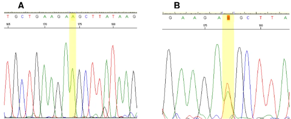 Figura 6  –  Mutação D116E identificada em homozigose (A) e em heterozigose (B),        no gene ERG11 de C