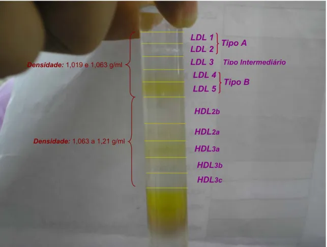 Figura 10 -   Classificação das Subfrações de LDL e HDL. 