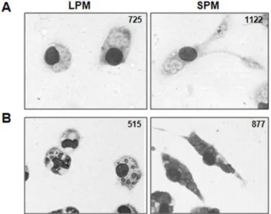 Figura 10  –  Avaliação da capacidade fagocítica de SPM e LPM. Células peritoneais de animais  C57BL/6  controles  foram  coletadas  e  colocadas  em  cultura  para  aderir  por  4  h