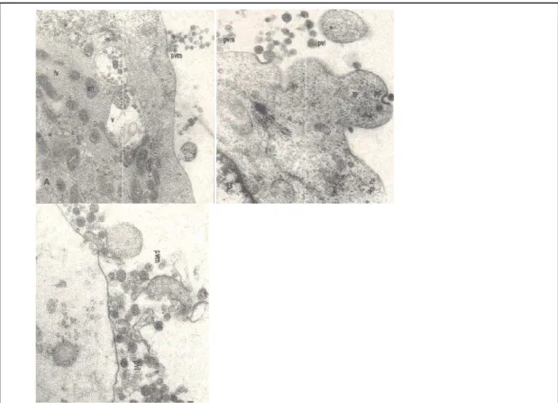 Figura 1.  Estrutura das partículas virais infectando um linfócito T (Microfotografia  de  autoria  de Olga Pfeilsticker, ICB, UFMG)