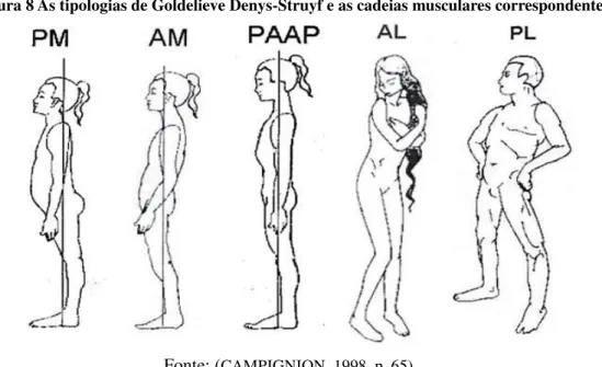 Figura 8 As tipologias de Goldelieve Denys-Struyf e as cadeias musculares correspondentes 