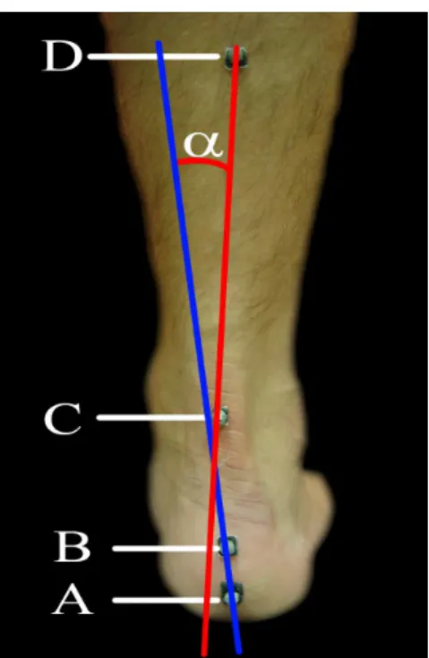 Figura 8: Ângulo relativo entre os segmentos Calcâneo (A-B) - Tíbia (C-D). 