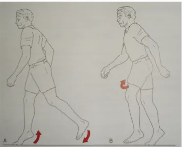 Fig. 5: Marcha Artrogênica (hipomobilidade de quadril ou joelho).