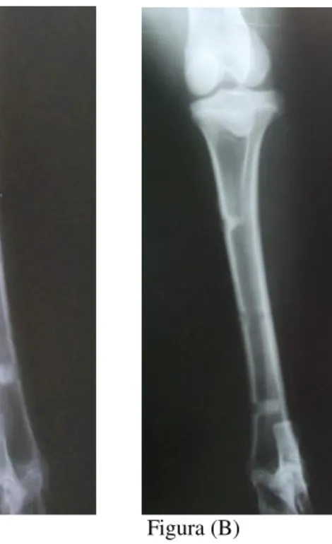Figura 5 – (A) Radiografia da tíbia esquerda de ovino obtida no período  pós-operatório imediato