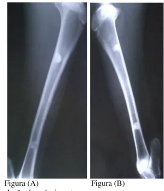 Figura 7 - (A) Radiografia da tíbia esquerda de ovino obtida aos 60 dias  de  pós-operatório
