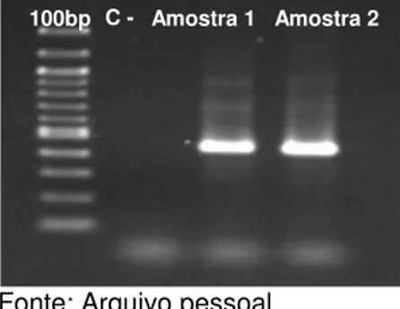 Figura  2  –   Eletroforese  em  gel  de  agarose  a  1,5%  corado  com  brometo  de  etídeo  demonstrando  a  amplificação  do             fragmento de 440 pb do gene  env das amostras 1 e  2 pela técnica de PCR 