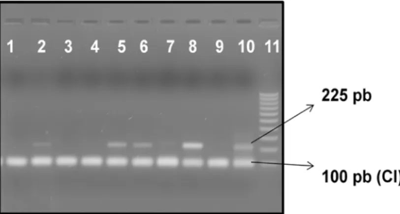 Figura 12. Eletroforese em gel de agarose  1%.  Nested-PCR  de tecidos fetais para o  PVS1 com CIA