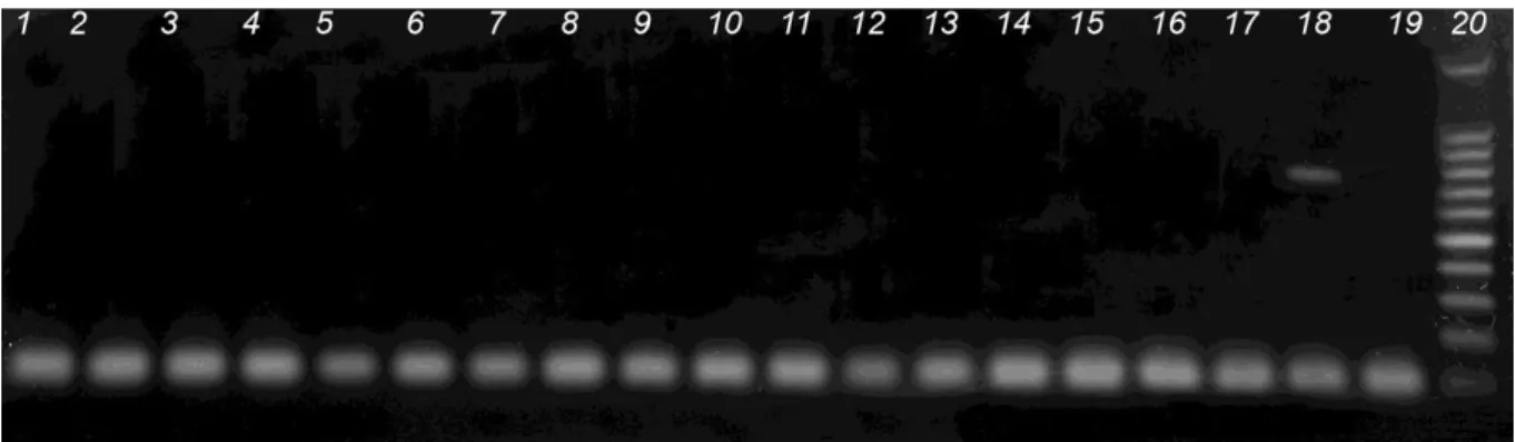 Figura  6  –   Amostras  de  sangue  das  porcas  testadas:  (1)  a  (17)  testes  sem  amplificação  de  DNA;  (18)  Controle  positivo,  (19)  Controle  negativo  (água  ultrapura);  (20)  Marcador  100  pb  (Cenbiot®)