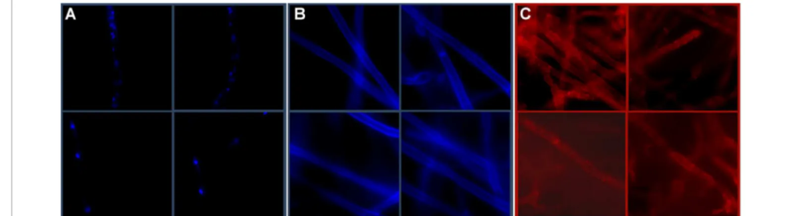 Figure 1: Fluorescence microscopy of stained P. cinnamomi mycelium at different locations