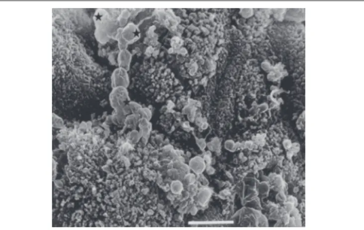 FIGURE 4. Scanning electronic microscopy of intact ileal mucosa with mucus  over the preserved brush border ( ★ - mucus layer)