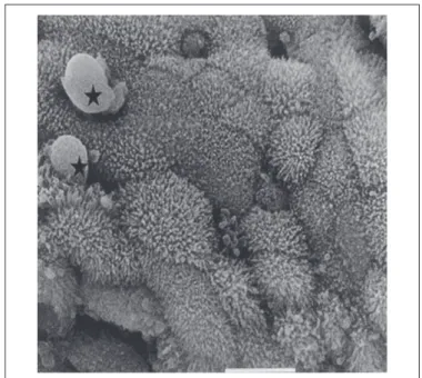 FIGURE 6. Scanning electronic microscopy of intact colonic mucosa with  mucus ( ★ ) over the preserved brush border (2000X; bar - 10 µm)