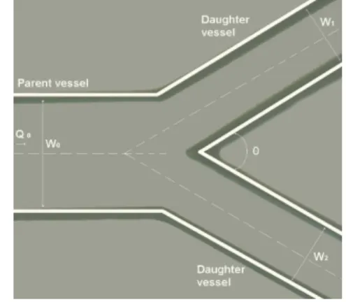 Fig. 1 Diagram of the symmetrical bifurcation geometry  used. Here Q 0  = 0,18 l/min, W 0  = 150 µm, W 1  = 75 µm,  W 2  = 75 µm, θ = 60º, depth = 50 µm