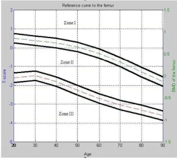 Figure 1 represents the Zone I, II and III and the region BMD L .