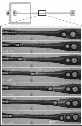 Figure 12. Visualization of bubbles generation and in vitro blood flow containing bubbles  through a flow-focusing device fabricated by xurography