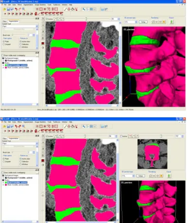 Figure 3. Rendering and 3D previewing in ScanIP ®  software. 