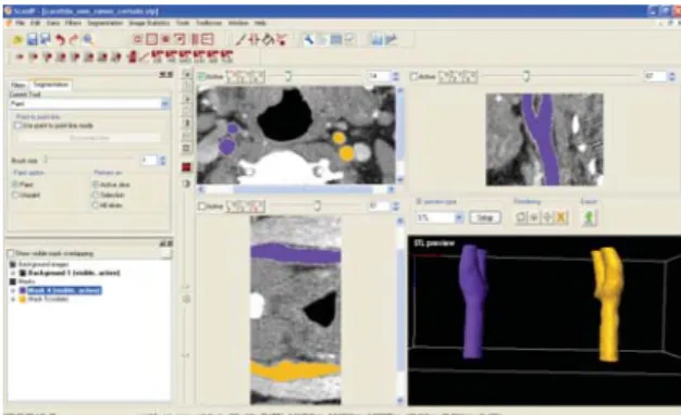 Figure 1: Different working plans in ScanIP® software. 