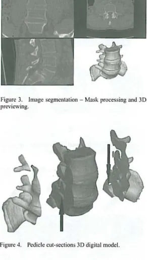 Figure 4.  Pcdiclc cut-scctions 3D digital model. 