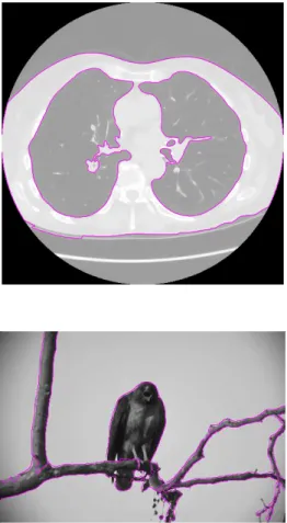 Figura 3.8: Resultados da segmentação relativos a uma imagem de TC aos pulmões e a uma imagem natural.