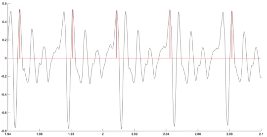 Figura 16 - Sinal de voz controlo da vogal /a/ tom alto, ilustrativa de que a determinação  seria melhor  efetuada através dos picos negativos