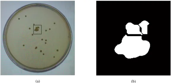 Figure 19: (a) example of a clustered colony with a big area (inside the black box); (b) result of watershed operation  for the clustered colony inside the black box