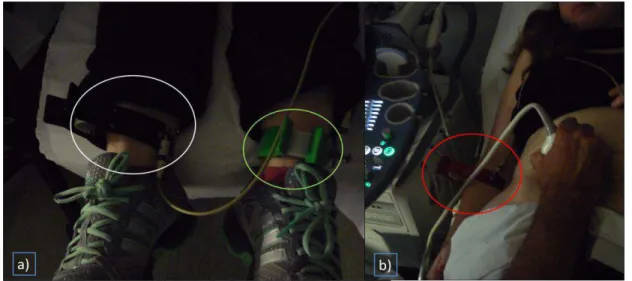 Figura 9.Melhor visualização dos elétrodos, a) dois elétrodos nos pés (preto- perna direita; verde- perna esquer- esquer-da); b) colocação no braço direito, a vermelho