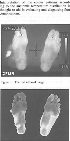 Figure 3.  Foot regions. 