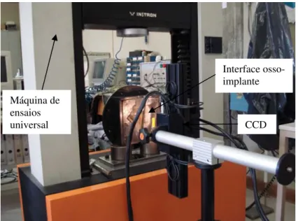 Figura 4. Set up experimental para a medição dos deslocamentos e deformações na interface osso- osso-implante