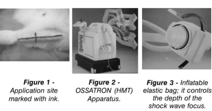 Figure 2 - -OSSATRON (HMT)