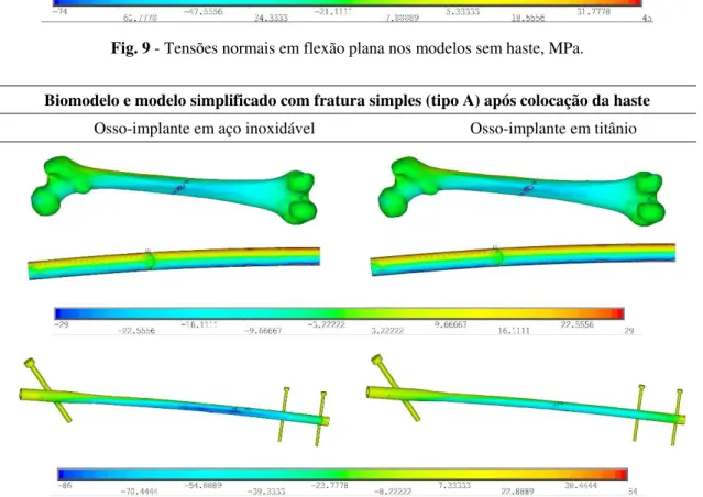 Fig. 10 - Tensões normais em flexão plana nos modelos com fratura simples, MPa. 