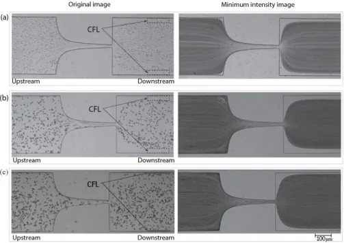 Figure 5. Images of (a) Red Blood Cells (RBCs) flow, B1, (b) two-phase viscoelastic solution flow, X2 and (c) PMMA particles in Dx40 flow, D2