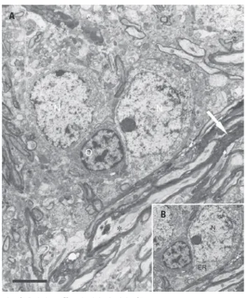 Figure 2. Electron micrographs from cross-sections of rat paratrigeminal  nucleus (Pa5) after the sinoaortic baroreceptor denervation