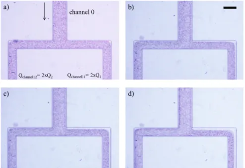 Fig. 2. Typical bright ﬁ eld microscopy image obtained in these experiments (a); image obtained from the stack (80 frames) using the median intensity projection method (b); scale bar corresponds to 200 lm.